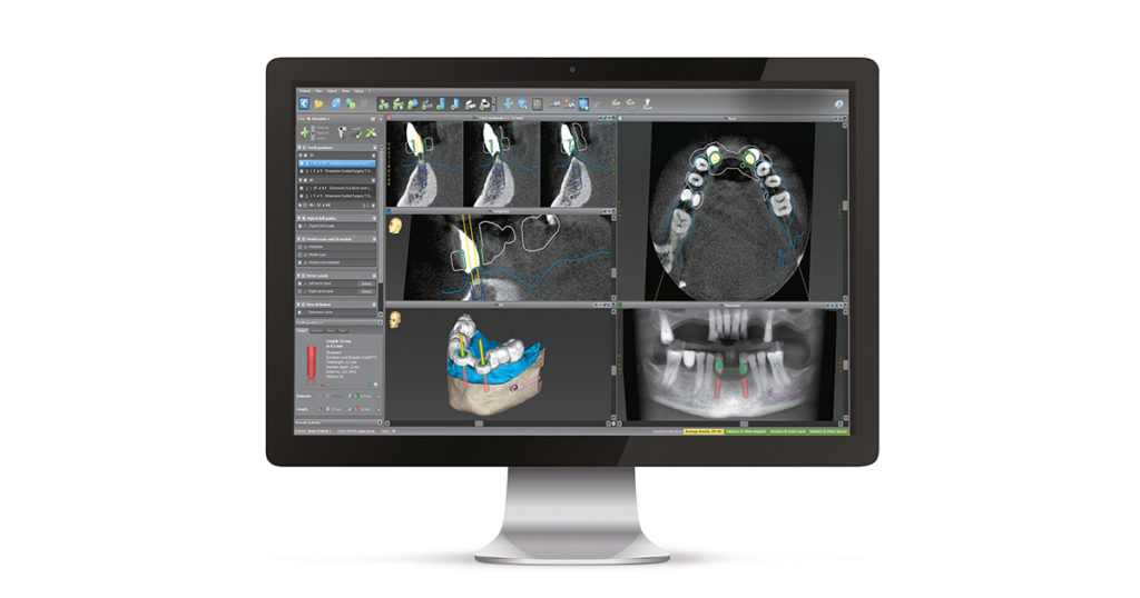 CoDiagnostiX obrazovka