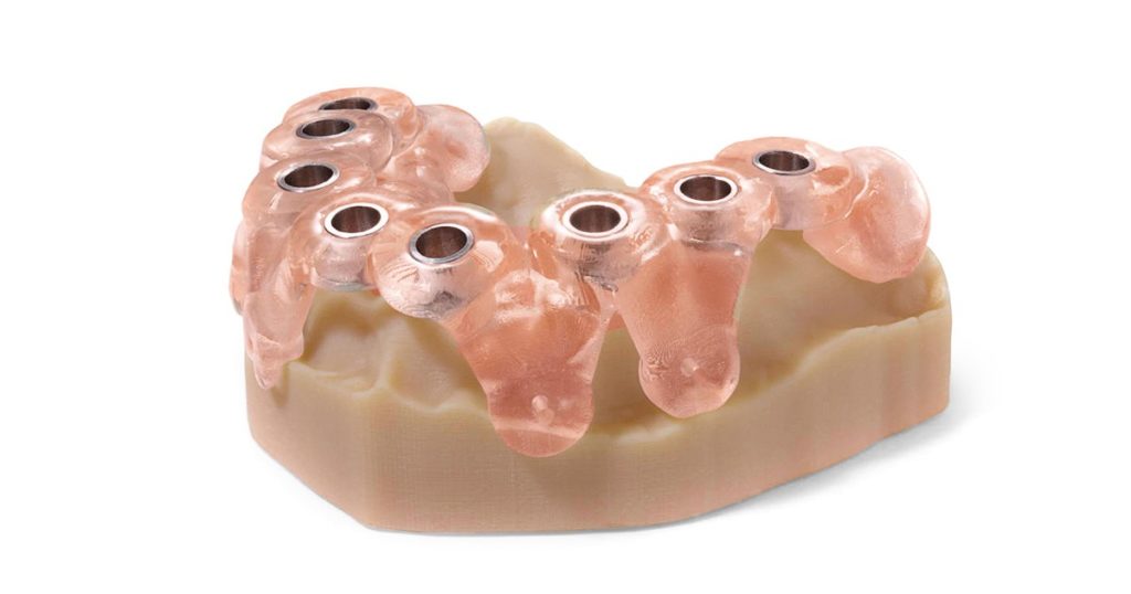 Implantační šablona